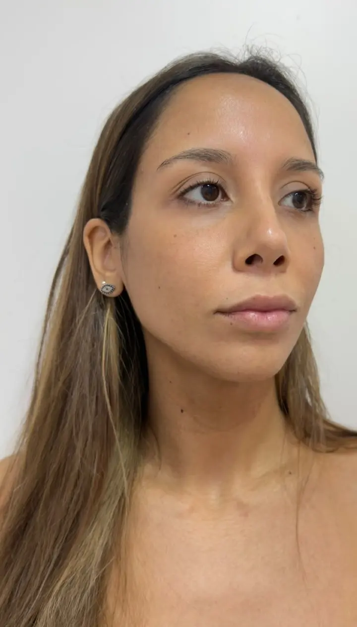 Paciente antes do procedimento