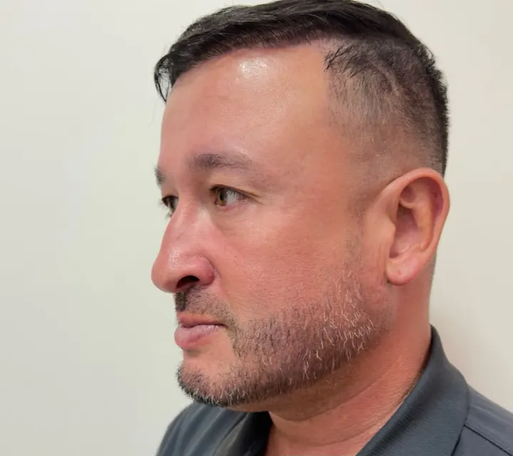 Perfil de paciente antes do procedimento
