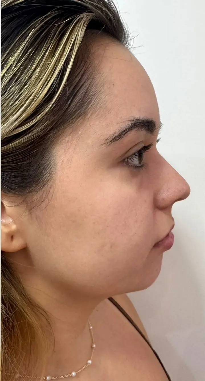 Perfil de paciente antes do procedimento