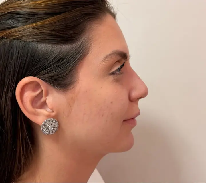 Perfil de paciente antes do procedimento