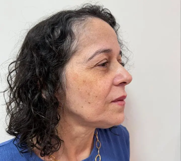 Perfil de paciente antes do procedimento